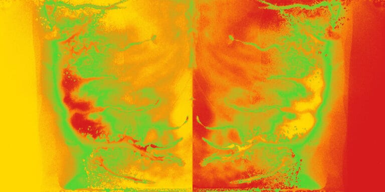 Image for FASCIA